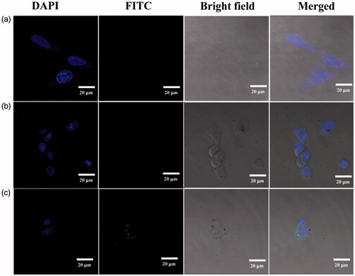 Figure 2. Confocal microscopy images of apoptotic C6 cells treated with PBS (a), Au DENPs (b), and duramycin-Au DENPs (c) at the Au concentration of 4 μM for 2 h, respectively.