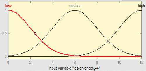 Figure 7. Membership functions of 2 mm ≤ulcer length ≤ 4 mm