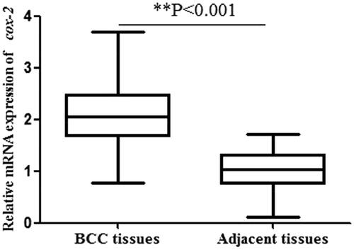 Figure 1. Relative cox-2 mRNA expression in BCC tissues and adjcant normal tissues. The mRNA expression of cox-2 in BCC tissues were significantly higher than that in adjacent normal tissues (p < .001).