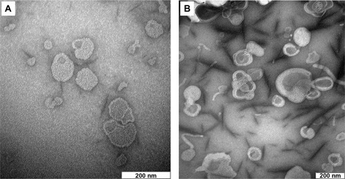 Figure 1 Transmission electron microscope image of (A) blank liposome and (B) diclofenac sodium-loaded liposome.