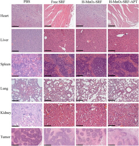 Figure 11. H&E staining of heart, liver, spleen, lung, kidney and tumor sections collected from mice in each group after the process (scale: 50 μm).