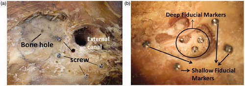 Figure 1. (a) Titanium screws and bone hole in bone surface; (b) Shallow and deep fiducial markers for the measurement of registration resolution.