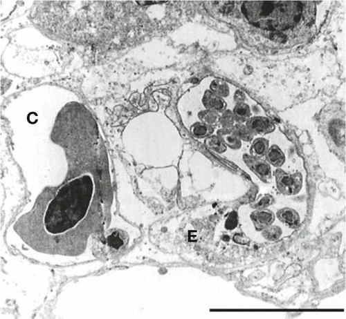 Figure 3. Transmission electron micrograph of a section of lung from a mohua (Bird 5) which died due to infection with Plasmodium spp., showing a protozoal schizont containing numerous merozoites within a parasitophorus vacuole in the cytoplasm of an endothelial cell (E). The adjacent capillary (C) contains a nucleated erythrocyte (bar=5 µm).