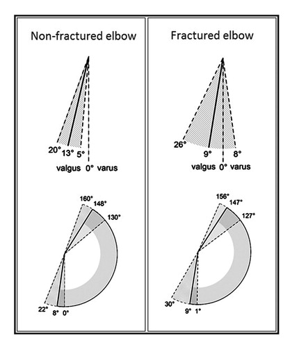Figure 2. Carrying angle and elbow range of motion in 65 patients at mean 9 years after pin fixation of supracondylar humerus fracture.