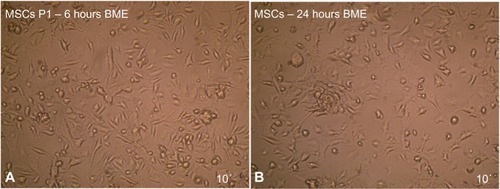 Figure 10 Neural stem cells induction by (A) 6 and (B) 24 hours exposure to BME as revealed under inverted microscope.