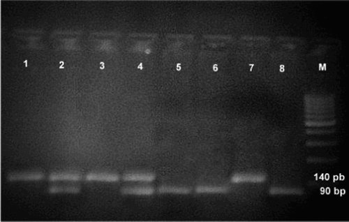 Figure 2 Genotyping of eNOS T-786C polymorphism in the promoter region. Lanes 1, 3, and 7 show 140 bp bands, denoting wild type (T) allele. Lanes 5, 6, and 8 show 90 bp bands, denoting homomutant type (C) allele. Lanes 2 and 4 show bands at 140 and 90 bp, denoting heteromutant type (TC). M is a marker ladder. NB: Bands at 50 and 40 bp could not be seen.