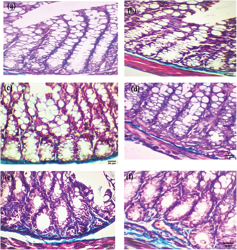 Figure 3. Photomicrograph of colorectal section post-4 weeks through mucosa layer showing (a) control group with mild collagen deposition, (b) EDTA, (c) DMSO, (d) Nic, (e) DMH, and (f) Nic-DMH groups with moderate collagen deposition. (Masson’s trichrome staining, scale bar: 50 µm).