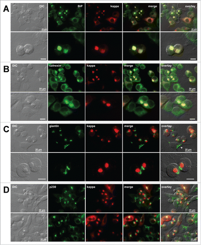 Figure 5. Organization of secretory pathway organelles in Russell body-positive cells. Fluorescent micrographs of HEK293 cells transfected with N35W variant LC construct. On day-2 post transfection, suspension cultured cells were seeded onto poly-lysine coated glass coverslips and statically incubated for 24 hr. On day-3, cells were fixed, permeabilized, and co-stained with Texas Red-conjugated anti-kappa chain polyclonal antibody and specific antibodies against various organelle markers. (A, B) ER markers BiP and calnexin. (C) A cis-/medial-Golgi marker giantin. (D) A trans-Golgi marker p230. Green and red image fields were superimposed to create ‘merge’ views. DIC and ‘merge’ were superimposed to generate ‘overlay’ views. In panel C top row, arrowhead points to a normal ribbon-like Golgi morphology in a non-transfected cell. Unlabeled scale bar represents 10 μm.