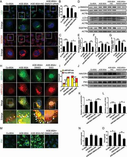 Figure 2. Inhibition of SMAD3 improves autophagic flux and protects HK-2 cells from injury after treatment with AGE-BSA. (A) Immunofluorescence staining of LC3 and SQSTM1 in HK-2 cells with or without SMAD3 gene knockdown after exposure to 30 μg/ml AGE-BSA or 30 μg/ml Co-BSA for 24 h. (B and C) Quantification of LC3 and SQSTM1 puncta. (D–G) Western blot analysis of phospho-SMAD3, LC3, and SQSTM1 expression in AGE-BSA or Co-BSA-treated HK-2 cells. (H) Fluorescent microscopic analysis of autophagic flux in RFP-GFP-LC3 plasmid-transfected HK-2 cells. After transient transfection with RFP-GFP-LC3 plasmids, HK-2 cells were pretreated with 10 µM SIS3 or 10 µM dimethyl sulfoxide (DMSO) for 1 h and exposed to AGE-BSA or Co-BSA. The yellow puncta indicate autophagosomes (arrowheads), and red puncta indicate autolysosomes (arrows). (I) Quantitative data for autophagosomes or autolysosomes in each cell. (J–L) Western blot analysis of HAVCR1 and FN1 expression in AGE-BSA or Co-BSA-treated HK-2 cells. (M) Immunofluorescence staining of FN1 in HK-2 cells. (N and O) ELISA of HAVCR1 and FN1 in the HK-2 cell culture supernatants. Bars represent means ± SEM for at least 3 independent experiments. *P< 0.05, **P< 0.01, and ***P< 0.001. DAPI was used to stain nuclei. Scale bar: 10 μm