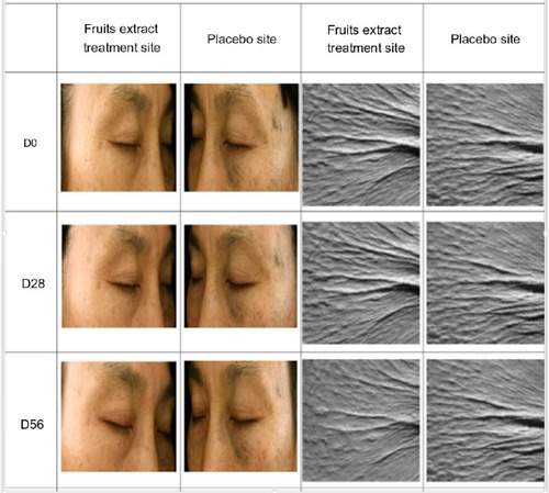 Figure 2 Photograph showing the images of wrinkles used for assessment of wrinkle area, depth, and length in the crow’s feet region of subject’s eyes treated with 2% topically formulated fruits extract and placebo treated for 56 days. Clinical evaluations and measurements were performed on D0 (before treatment), D28, and D56.