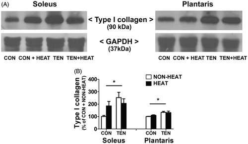 Figure 6. Effects of heat stress and tenotomy on type I collagen protein expression in soleus and plantaris muscles. (A) Representative type I collagen protein expression using western blotting. (B) Quantified data of type I collagen. Type I collagen band density was normalised with GAPDH (n = 5–6 rats/group). *p < 0.05 vs. respective CON within each muscle.