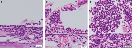 Figure 1. Histological sections of the middle ear of an animal model for eosinophilic otitis media (EOM) (H&E staining): from the 7-day (A), 14-day (B), and 28-day (C) ovalbumin (OVA) stimulation sides.