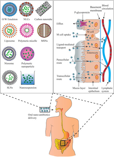 Figure 1 Types of oral antibiotic nanopreparations and mechanisms by which oral absorption improvement of antibiotics through nano-drug delivery system.
