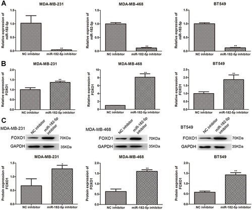 Figure 5 Expression of FOXO1 in the TNBC cell lines transfected with miR-182-5p inhibitor. (A) Cell transfection efficiency of TNBC cell lines after transfection with miR-182-5p inhibitor by determining miR-182-5p level using qRT-PCR. The mRNA expression (B) and protein expression (C) of FOXO1 in the TNBC cell lines after transfection using qRT-PCR and Western blot. *P < 0.05, **P < 0.01, vs NC inhibitor.