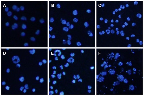 Figure 7 Morphologic characterization of Raji cells after different treatments for 48 hours under inverted fluorescence micrographs (100×, 4′,6-diamidino-2-phenylindole staining). (A) Control group; (B) 80 mg/L magnetic nanoparticles; (C) 12.5 μmol/L wogonin; (D) 12.5 μmol/L wogonin-magnetic nanoparticles; (E) 50 μmol/L wogonin; (F) 50 μmol/L wogonin-magnetic nanoparticles.