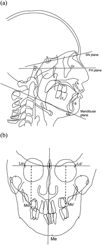 Figure 1. Lateral and posterior-anterior (PA) cephalometric landmarks and planes. (a) S, sella; N, Nasion; Po, porion; Or, orbitale; A, subspinale; B, supramentale; U1, incisal edge of upper first incisor; L1, incisal edge of lower first incisor; Me, menton; FH plane, Frankfort horizontal plane; Mandibular plane, tangent line of the lower border of the mandible. (b) Lo (‘), right and left Latero-orbitale; Mo (‘), right and left side of the intersection of the maxillary bone and the maxillary first molar.