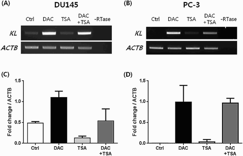 Figure 4. Restoration of the KLOTHO mRNA by treatment with DAC and TSA in prostate cancer cell lines DU145 and PC-3, respectively.