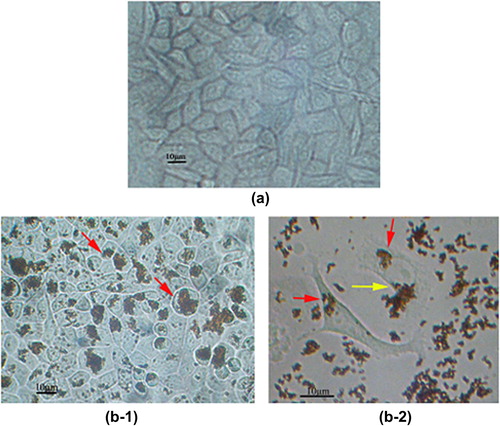 Figure 8. (a) Microscopy image of the untreated SMMC-7721; Microscopy images of SMMC-7721 after incubation with (b-1 and b-2) MNPs.