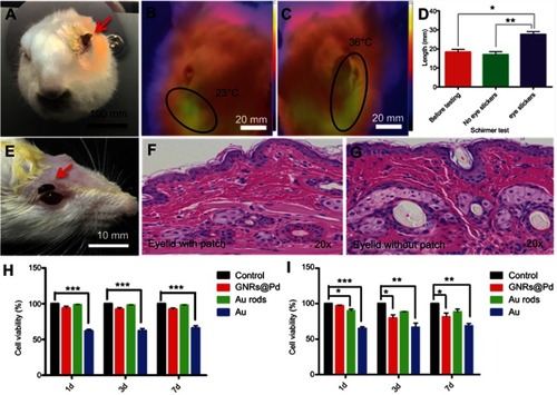 Figure 3 The safety assessment of the eye patch. (A) A photo of a rabbit pasted with an eye patch. (B, C) The infrared heat distribution maps of the rabbit eye with or without the eye patch. (D) The tear secretion test of rabbit eyes. (E) The picture of the mouse paste eye patch. (F, G) The HE staining of the mouse’s eyelid skin without or with the eye patch for 24 hours. (H) The cytotoxicity tests by using 293 cells. (I) The cytotoxicity tests by using R28 cells. Each group contains four samples, Error bars: SEM. Unpaired t-test, *P<0.05, **P<0.01, ***P<0.001.Abbreviations: HE, hematoxylin-eosin; GNRs@Pd, gold nanorods @ palladium.