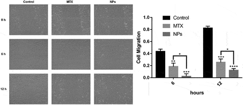 Figure 10. Migration of MDA-MB-231 cells after treatment with free MTX and nanoparticles for 0, 6 and 12 hours; * P <0.05 and * * P <0.01 indicate significant differences, * * * P <0.001 and * * * * P <0.0001 indicate highly significant differences.