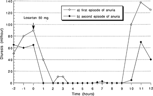 Figure 1. Evolution of the diuresis during the two episodes of anuria.