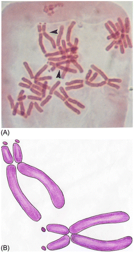 Figure 3. Subtelocentric chromosomes with satellites (arrows); some chromosomes are damaged.