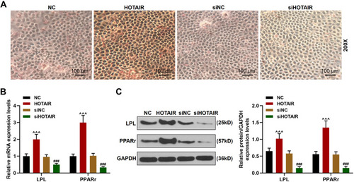 Figure 5 Adipogenic differentiation in BMSCs was enhanced by overexpression of HOTAIR and inhibited by siHOTAIR. (A) The formation of lipid droplets in BMSCs after transfection was detected by Oil Red O staining (Magnification ×200). (B) The expressions of LPL and PPARr in BMSCs after transfection were detected by RT-qPCR. GAPDH was an internal control. (C) The expressions of LPL and PPARr in BMSCs after transfection were detected by Western blot. GAPDH was an internal control. All experiments were conducted in triplicate. (^^^P < 0.001, vs NC; ###P < 0.001, vs siNC).