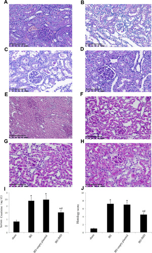 Figure 2 Histological and renal function assessments. (A–D) Renal pathomorphological changes after renal ischemia-reperfusion injury (IRI) shown by H&E staining, original magnification, ×400. (A) Sham groups. (B) IRI groups. (C) IRI+empty plasmid groups. (D) IRI+IMD groups. (E–H) Renal pathomorphological changes after renal ischemia-reperfusion injury (IRI) shown by PAS staining, original magnification, ×400. (E) Sham groups. (F) IRI groups. (G) IRI+empty plasmid groups. (H) IRI+IMD groups. (I) Serum creatinine concentration. (J) Semiquantitation of the morphological changes by the histological grading system. Data in bar graphs are the means ± SD, n = 20. *P < 0.05 vs sham group; #P < 0.05 vs IRI group.