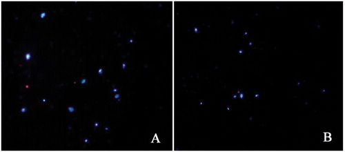 Figure 11. Fluorescence photomicrographs of C6 cells transfected with NPs-c-Myc-siRNA3-pDNAs after Hoechst33258 and propidium iodide double staining: (A) normal C6 cells and (B) C6 cells transfected with NPs-c-Myc-siRNA3-pDNAs for 48 h.