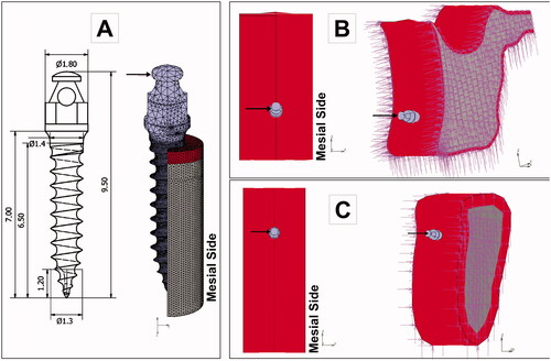 Figure 2. Boundary conditions of the finite element models. A mesial load was applied to the head of the mini-implant, and the displacement of the nodes located at the cutting bone surfaces was restricted (zero degrees of freedom). A: OMI dimensions and loading. B: Maxilla models. C. Mandible models.