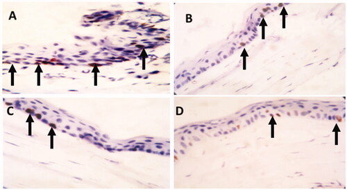 Figure 5. Ki-67 immunostaining of the corneal tissue of adult male albino rabbits 14 days after carrageenan injection. (A) Group I (non-treated group) showing many cells expressing ki-67 (arrow). (B) Group II (plain drug hydrogel) showing some positive cells for ki-67 (arrow). (C) Group III (micellar solution) showing few positive cells expressing ki-67 (arrow). (D) Group IV (TA micelles/chitosan hydrogel) showing that the expression of ki-67 is rare and very low (arrow) (Counter stain hematoxylin ×40).