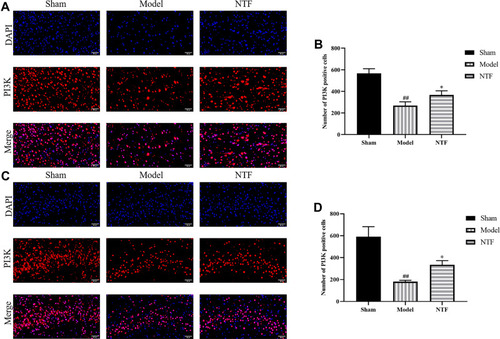 Figure 11 Effects of NTF 7 days prior to CIRI on expression of PI3K of the ischemic cortex and hippocampus in rats 24 h after reperfusion. (A) Representative images magnified 400 times in ischemic cortex sections examined with specific antibody against PI3K (red); nuclei were stained with DAPI (blue). (B) The numbers of PI3K positive cells in each group after 24 h of reperfusion in ischemic cortex. (C) Representative images magnified 400 times in ischemic hippocampus sections. (D) The numbers of PI3K positive cells in each group after 24 h of reperfusion in ischemic hippocampus. All data were presented as mean ± SD. ##p<0.01 versus sham group; *p<0.05 versus model group, respectively.