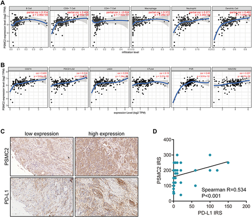 Figure 3 Association between PSCM2 expression and TME features in pancreatic cancer. (A) PSCM2 expression in pancreatic cancer tissues is positively correlated with infiltration levels of B cells, CD8+ T cells, CD4+ T cells, macrophages, neutrophils, and DCs. (B) PSCM2 expression in pancreatic cancer tissues is positively correlated with immune checkpoints expression, including PD-L1, PD-L2, LAG3, CTLA4, PVR, and HAVCR2. (C) Representative images uncovering low and high PSMC2 and PD-L1 expressions in pancreatic cancer using anti-PSMC2 and anti-PD-L1 staining. (D) Correlation between PSMC2 and PD-L1 expressions in pancreatic cancer tissues.