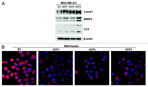 Figure 7. MDA-MB-231 cells overexpressing UCP1, UCP2 or UCP3 display increased autophagy and decreased mitochondrial activity. UCP1, UCP2, UCP3 overexpressing breast cancer cells and vector-alone (EV) control cells were grown for 48h in complete media. (A) Immunoblot analysis using antibodies directed against a panel of autophagy markers. Note that all three UCP isoforms induce autophagy, by upregulating the expression levels of Lamp1, BNIP3 and LC3. (B) MitoTracker staining (red) was used to visualize mitochondrial activity. Nuclei were stained with DAPI (blue). Note that cancer cells harboring UCP1, UCP2 or UCP3 show reduced MitoTracker staining, relative to control cells, thus indicating decreased mitochondrial activity.