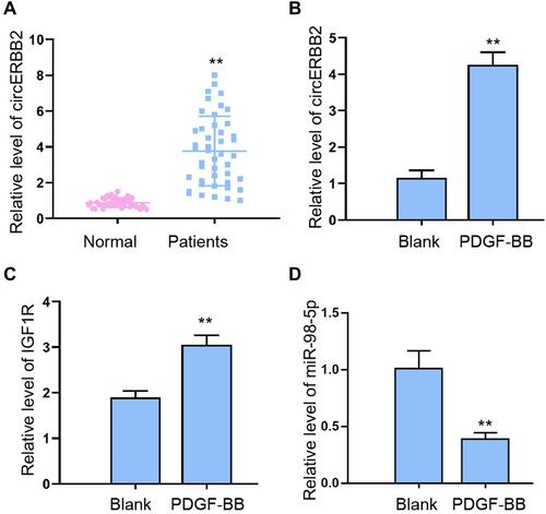 Figure 1 The expression of circERBB2 was upregulated in the biopsy samples of patients with asthma and PDGF-BB-stimulated ASMCs. (A) QRT-PCR quantification of circERBB2 level in biopsy samples collected from patients with asthma (n=45) and healthy donors (n=45). (B-D) ASMCs were stimulated with PDGF-BB (25 ng/mL) for 24 hours, the levels of circERBB2, IGF1R, and miR-98-5p were detected by qRT-PCR assay. *p < 0.05, **p < 0.01.