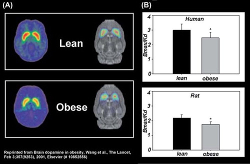 Figure 1. Obesity-related deficits in striatal dopamine D2 receptors (D2R) are conserved across species: (A) representative positron emission tomography brain scans and (B) Bmax/Kd values of D2R binding in lean and obese humans (CitationWang et al., 2001) and rats (CitationThanos et al., 2008).