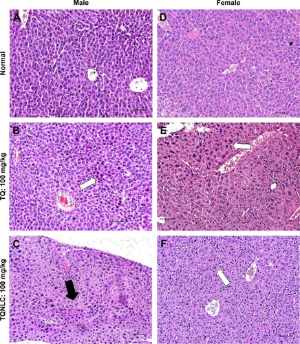Figure 3 Liver sections of BALB/c mice after treatment with TQ and TQNLC in the subacute toxicity study.Notes: No histological changes were observed in the mice treated with tap water (A and D). Pyknotic nucleus (white arrows) and cell degeneration (black arrow). B and E show liver of mice treated with 100 mg/kg of TQ, while C and F show liver of mice treated with 100 mg/kg of TQNLC. Each scale bar represents 100 μm.Abbreviations: TQ, thymoquinone; TQNLC, TQ-loaded nanostructured lipid carrier.