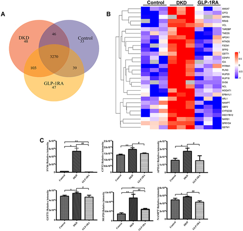 Figure 3 Identification of significant differentially expressed proteins (DEPs) in kidney of mice among three groups by LFQ-based proteomic analysis. (A) Venn diagram for overlapping proteins of the kidney among three groups (n=3). (B) Heatmap for the comparison of the DEPs among three groups (n=3). Red represents significantly up-regulated proteins, blue represents significantly down-regulated proteins, and gray represents no protein quantitative information. (C) The protein expression levels of SVS6, CPT2, APOA1, CSTT1, MUP20, and NAMPT in the kidney of mice among three groups were measured by proteomics analysis (n=3). Data are expressed as mean ± SD, *P<0.05, **P<0.01 vs control group; #P<0.05, ##P<0.01 vs DKD group.