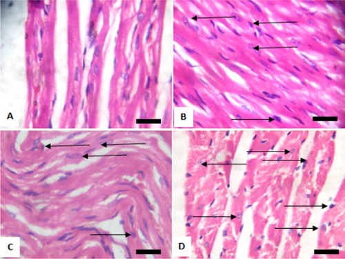 Figure 5. Photomicrograph showing heart of rats exposed to sodium arsenite orally for 4 weeks. (A) Control shows no significant lesion; (B) 10 mg/kg NaAsO3 mild pyknosis and necrotic cells (black arrows); (C) 20 mg/kg NaAsO3 reveals loss of striations and pyknotic cells (black arrows) and (D) 40 mg/kg NaAsO3 with loss of structural architecture, severe pyknosis and necrosis of cells (black arrows). Scale bar (for A, B, C and D) = 2.15 × 2.79 mm Plates are stained with H and E stains and viewed with ×100 objectives.