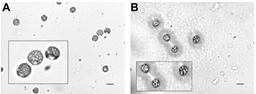 Figure 5 Representative microscopic spore shapes seen following in vitro acid digestion and zinc sulfate flotation.