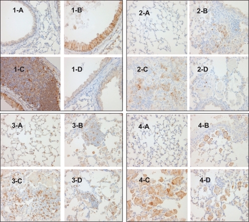 Figure 6 Effect of p38 MAPK inhibition on immune cell infiltration and activation in CC10:IL-13 mice [1] p-p38 MAPK IHC stain, x400 showing no p-p38 MAPK activation in Tg (−) mice (1-A), enhanced p-p38 MAPK activation in the epithelial cells of airway (1-B) and infiltrated lymphocytes(1-C) in the vehicle-treated Tg (+) mice and completed inhibition of p-p38 MAPK activation in the epithelial cells in the SD-282 high-dose treated Tg (+) mice (1-D). [2] IL-1β IHC stain, x400 showing no IL-1β expression in Tg (−) mice (2-A), mild IL-1β expression in the PMN cells in Tg (+) mice in baseline (2-B), increased IL-1β expression in the vehicle-treated Tg (+) mice (2-C) and less IL-1β expression in the PMN cells in the SD-282 high-dose treated Tg (+) mice (2-D). [3] CD3 IHC stain, x400 showing few CD3+ T-lymphocytes in the lung of Tg (−) mice (3-A), mild CD3+ T-lymphocyte infiltration in the lung of Tg (+) mice in baseline (3-B), markedly increased number of CD3+ T-lymphocyte in the lung of Tg (+) mice treated with vehicle (3-C) and significantly decreased number of CD3+ T-lymphocytes in the lung of Tg (+) mice treated with the high-dose of SD-282 (3-D). [4] F4/80 IHC, x400 showing no activated macrophages in the lung of Tg (−) mice (4-A), few activated macrophages in the lung of Tg (+) mice in baseline (4-B), markedly increased number of activated macrophages in the lung of Tg (+) mice treated with vehicle (4-C), and decreased number of activated macrophages in the lung of Tg (+) mice treated with high-dose of SD-282 (4-D).