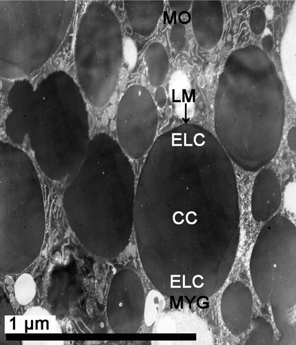 Figure 11.  Electron micrograph of a mature oocyte and a degenerating oocyte in female Protothaca (Notochione) jedoensis. (11) Mature yolk granules in a mature oocyte. Note a number of mature yolk granules (MYG) being composed of three parts: crystalline core (CC), electron lucient cortex (ELC), and a limiting membrane (LM, arrow).