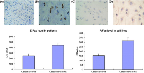 Figure 6. Changes of Fas level of OS in vivo and in vitro. (A) Fas (−) expression of OS patient ×400. (B) Fas (+) expression of osteochondroma patient ×400. (C) Fas (−) expression of OS cells ×400. (D) Fas (+) expression of osteochondroma cells ×400. (E) Quantitative analysis of Fas expression of OS patients and osteochondroma patients. (F) Quantitative analysis of Fas expression of OS cells and osteochondroma cells.