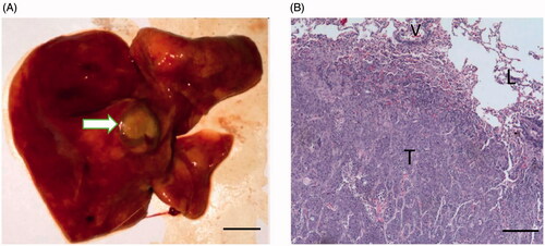 Figure 1. Gross specimen and pathological examination of a VX2 tumor after confirmation of successful tumor implantation. (A) The VX2 tumor located in the left lower lobe of the lung (arrow, scale bar = 1 cm). (B) Under the light microscope, the tumor cells occupied most of the lung parenchyma (T), and the tumor even invaded nearby vessels (V) and alveoli (L) (hematoxylin and eosin staining, ×10).