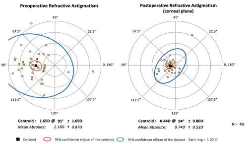 Figure 4 Preoperative and twelve month postoperative refractive astigmatism (n=40, D diopters).
