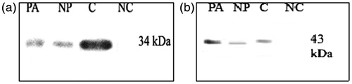 Figure 5. (a) and (b) Western blot analysis of SP-A and SP-D in prostate from control and prostate adenocarcinoma. A. Western blot of prostate extracts obtained from noncadenocarcinomas site (NP) and adenocarcinoma field (PA) were probed with antibodies against SP-A (a) and SP-D (b). Note: PA; prostate adenocarcinoma, NP; normal prostate, C; control, NC; negative control.