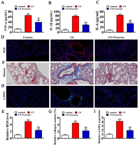 Figure 1. Exercise ameliorates COPD induced lung injury by inhibit ROS, inflammation and epithelial-mesenchymal transition (EMT). (A–C) ELISA detection shows the expression of inflammatory factor TNF-α, IL-1β, IL-6. Data are means ± SD. **p < 0.01, ***p < 0.001 vs. control. ##p < 0.01, ###p < 0.001 vs. CS. (D and E) Immunofluorescence detection shows the ROS level in lung tissues. Data are means ± SD. ***p < 0.001 vs. control. ###p < 0.001 vs. CS. (F and G) Representative images of lung sections after Masson trichrome staining. Data are expressed as mean ± SD. ***p < 0.001 vs. control. ##p < 0.01, ###p < 0.001 vs. CS. (H and I) Representative images and quantification of the α-SMA expression in the lung tissue samples in different groups. Data are expressed as mean ± SD. **p < 0.01, ***p < 0.001 vs. control. ###p < 0.001 vs. CS.