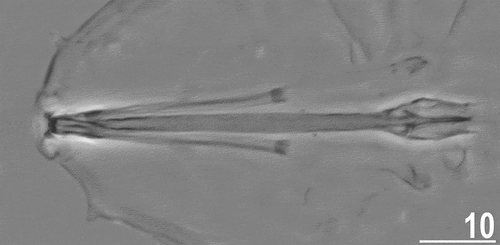 Figure 4. Buccal apparatus of Echiniscoides basalticus sp. nov. (PCM). Scale bar in μm.