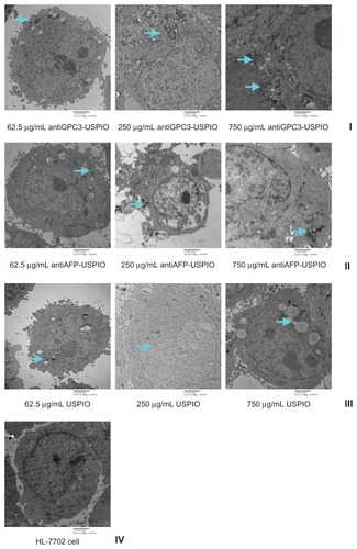 Figure 2 Hitach 7600 TEM demonstrates construction of the HPG2 cells (I–III), incubated with 750 μg/mL, 250 μg/mL, and 62.5 μg/mL iron content of antiGPC3-USPIO, antiAFP-USPIO and USPIO nanoparticles for 4 h at 37°C in 5% CO2, with a magnification of 10,000. As control, the HL-7702 hepatocytes incubated with iron content of 750 μg/mL iron content of antiGPC3-USPIO for 4 h at the same conditions were also demonstrated by TEM. The HPG2 cells took iron oxides in a concentration-dependent manner. However, the HL-7702 (IV) hepatocytes did not ingest the USPIO nanoparticles.Note: The arrow indicates the USPIO nanoparticles.Abbreviations: USPIO ultrasuperparamagnetic iron oxide nanoparticle; antiGPC3 USPIO: the probe was formed using antiglypican-3 monoclonal antibodies coupled with USPIO nanoparticles; antiAFP-USPIO: the probe was formed using antiAFP antibodies coupled with USPIO nanoparticles.