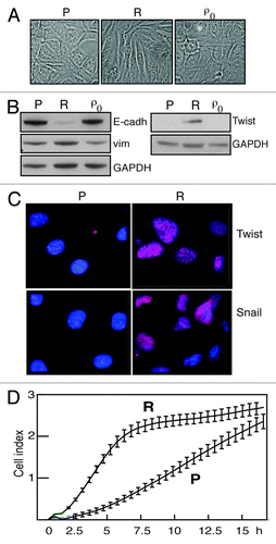 Figure 2. EMT and motility. (A) Phase contrast microscope (40x magnification) photomicrographs of SKOV-3 (P), SKOV-3-R (R) and SKOV-3-ρ0 (ρ0) cells. (B) western blots showing expression of E-cadherin (E-cadh), vimentin (vim) and Twist in the same cell lines. GAPDH served as loading control. (C) Immunofluorescence photomicrographs (60x magnification) showing levels and nuclear location of transcriptional repressors Twist and Snail, respectively, in SKOV-3 parental (P) and resistant (R) cells. Red: Twist or Snail; blue: DAPI nuclear stain. (D) Representative tracings of SKOV-3 (P) and SKOV-3-R (R) cells over 18 h from the automated assessment of motility toward a chemoattractant (serum-containing medium), using xCELLigence® equipment. Error bars represent standard deviation in quadruplicates. The experiment was performed three times with similar results.